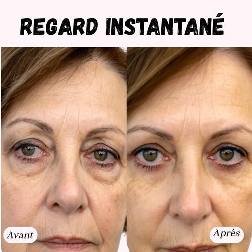 Masseur des contours yeux sonique