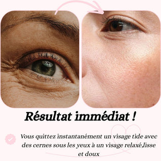 Masseur des contours yeux sonique