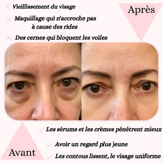 Masseur des contours yeux sonique