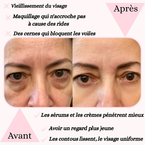 Masseur des contours yeux sonique